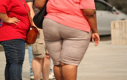 World’s most obese man dies after weight-loss surgery World’s most obese man dies after weight-loss surgery